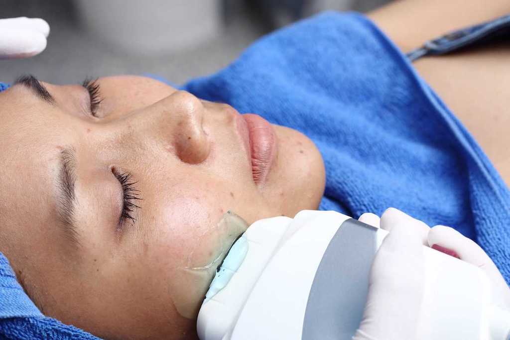 Factory Price Hifu Face and Body Slimming Reshaper Skin Tightening