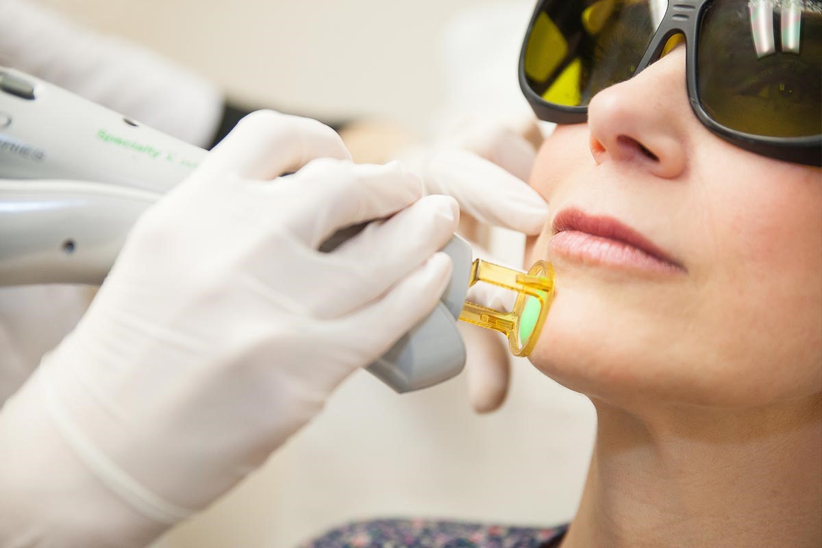 Laser Facial Hair Removal in Montreal IPL Lab Medispa