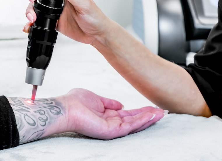 ▷ Removery Tattoo Removal & Fading, Surrey, BC, 2448 160 St #20 - Cylex  Local Search